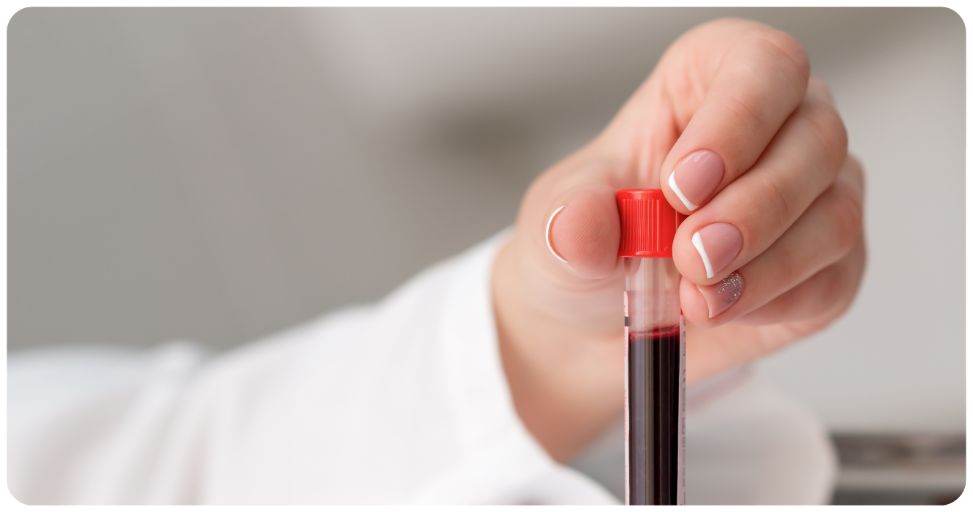 influence du vapotage sur les analyses